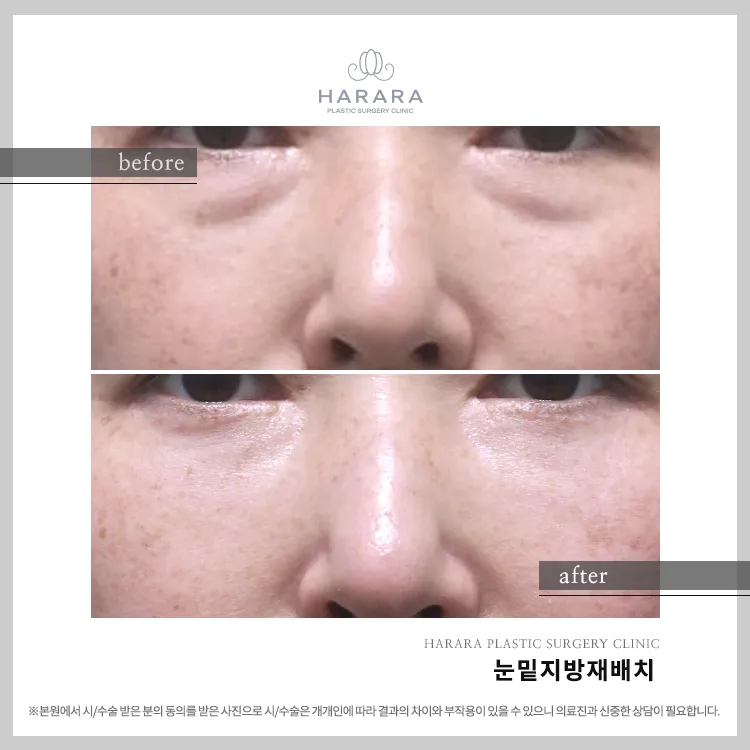 하라라성형외과의원 대표 이미지