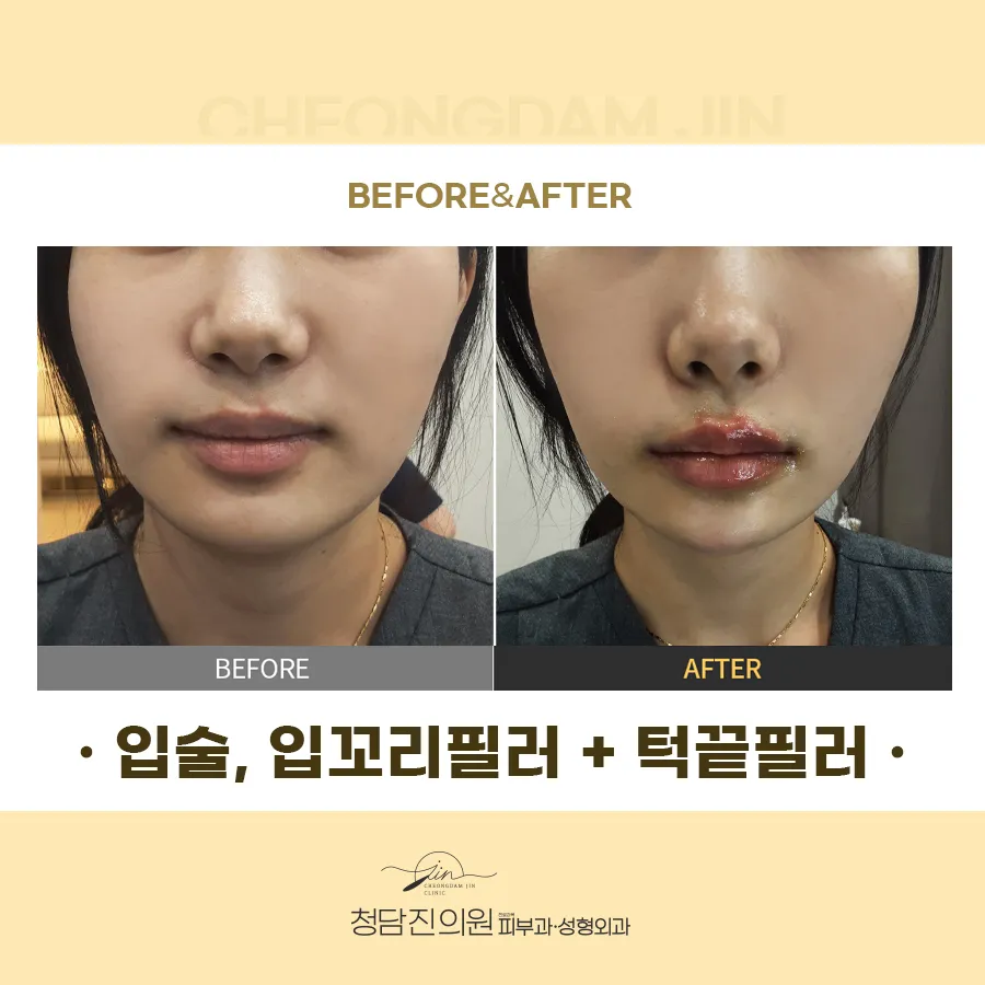 청담진의원 대표 이미지
