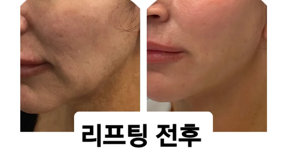 24까페거리의원 대표 이미지