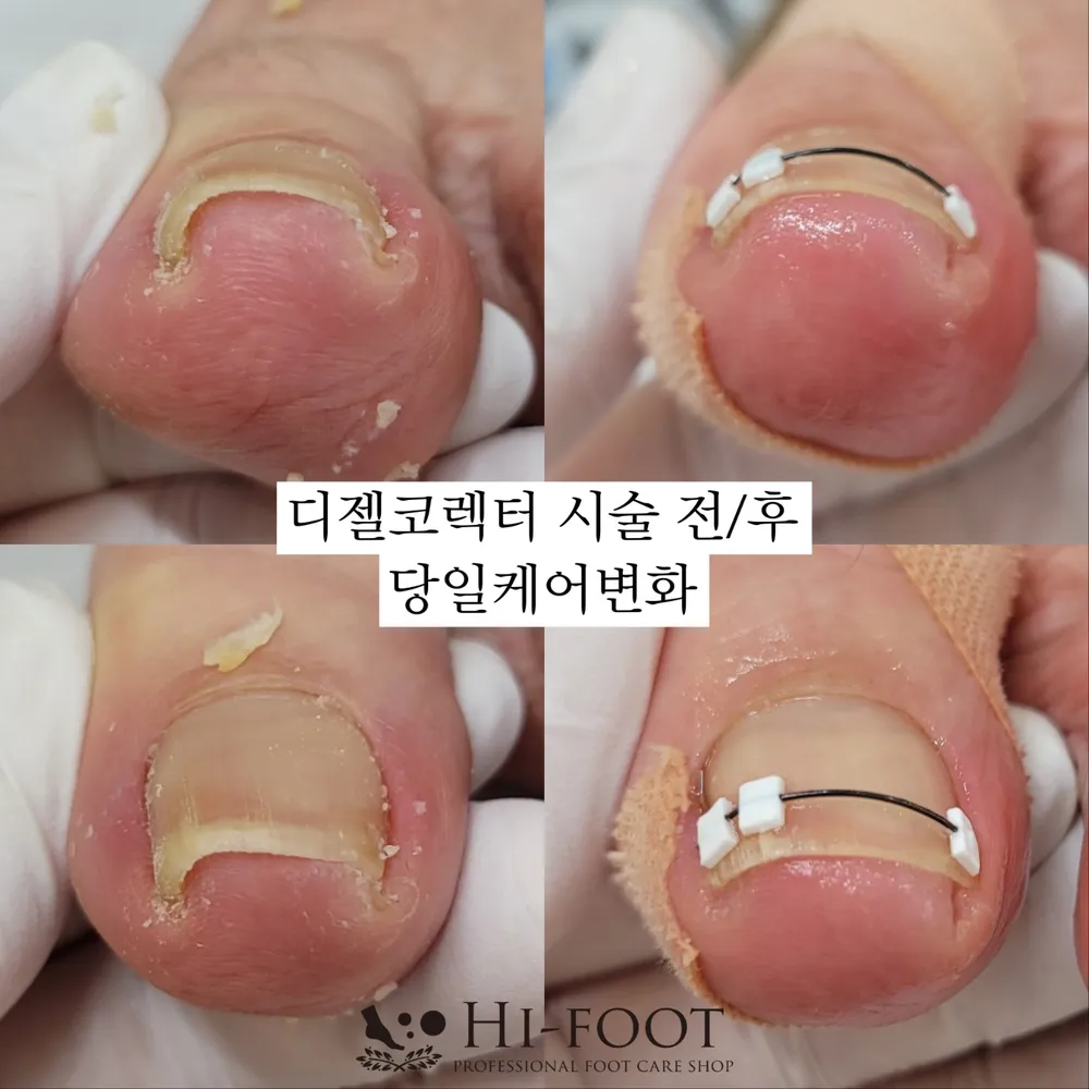 하이풋 본점 대표 이미지