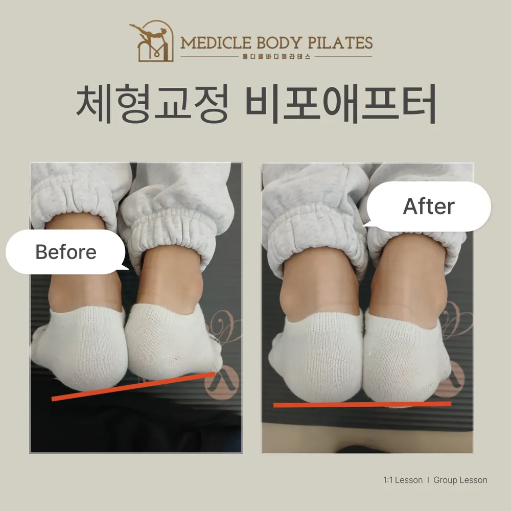 메디클바디필라테스 대표 이미지