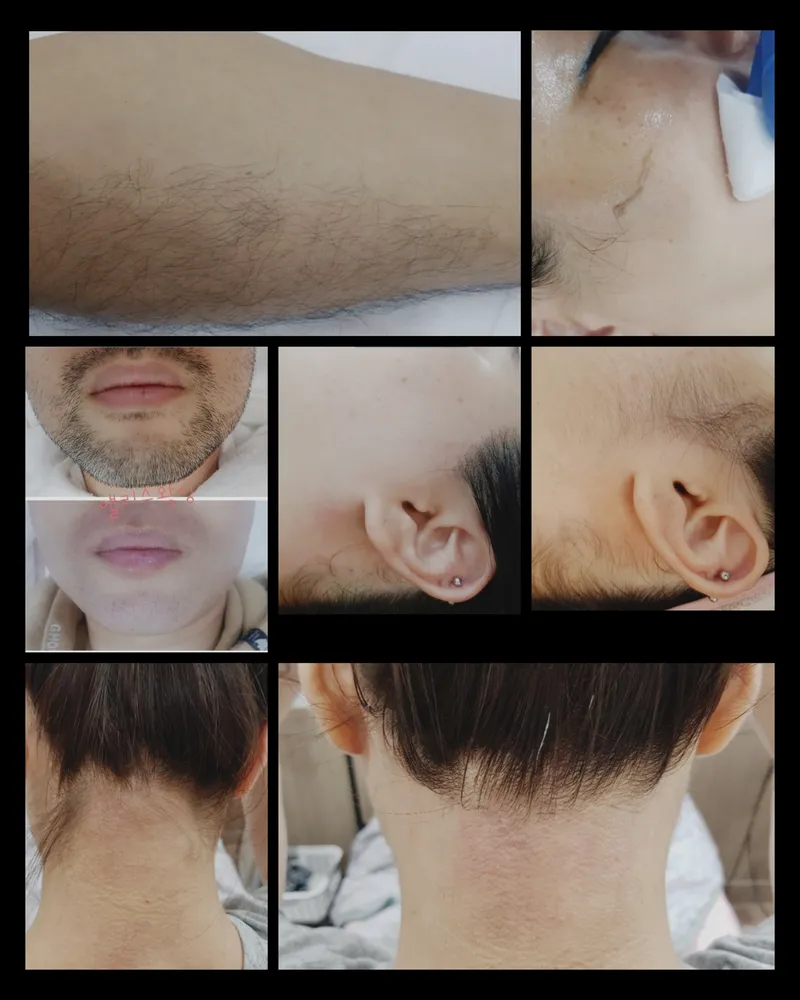 엘리스왁싱 대표 이미지