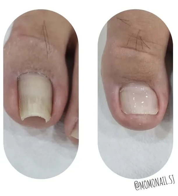 모모네일 대표 이미지