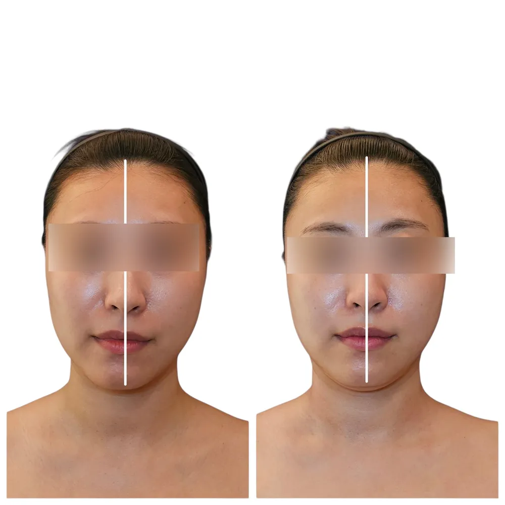 정형뷰티어겐 대표 이미지