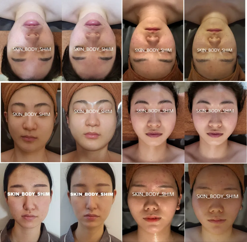 스킨앤바디 쉼 대표 이미지
