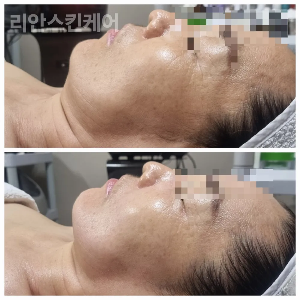 리안스킨케어 대표 이미지