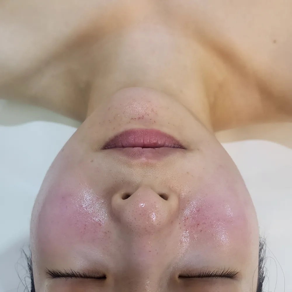 아이엠에스테틱 대표 이미지