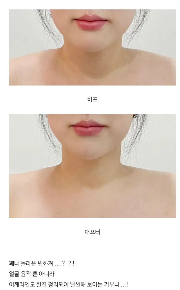 올리니끄 대표 이미지