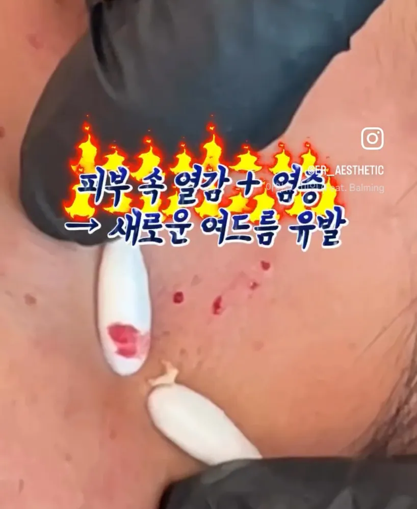에르에스테틱 대표 이미지