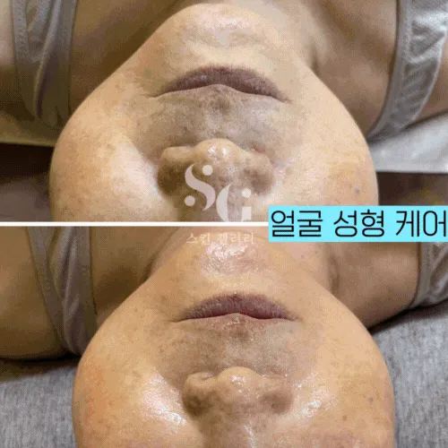 스킨갤러리 대표 이미지