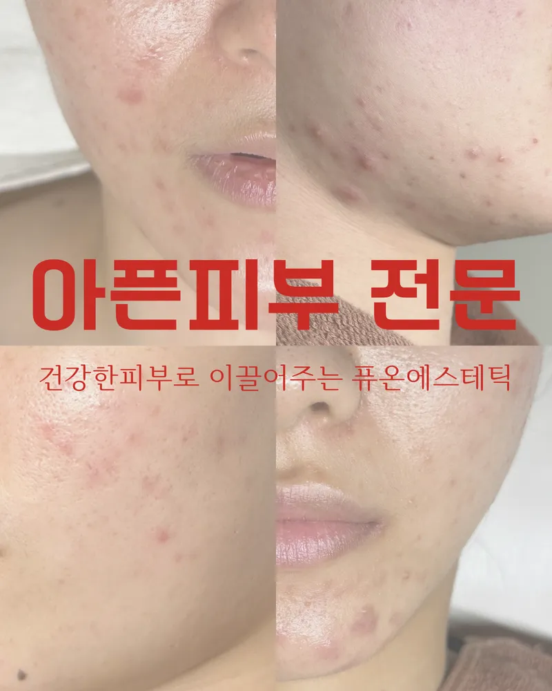 퓨온에스테틱 대표 이미지