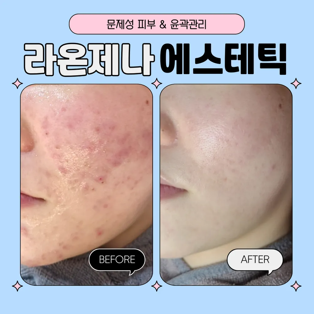 라온제나에스테틱 대표 이미지