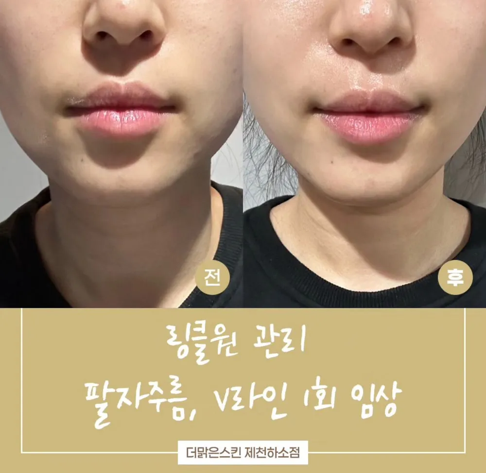 더맑은스킨 대표 이미지