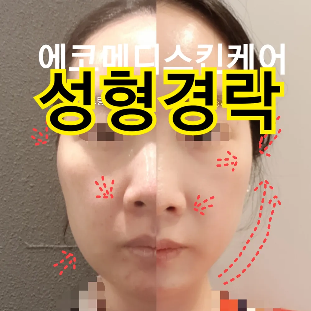 에코메디스킨케어 대표 이미지