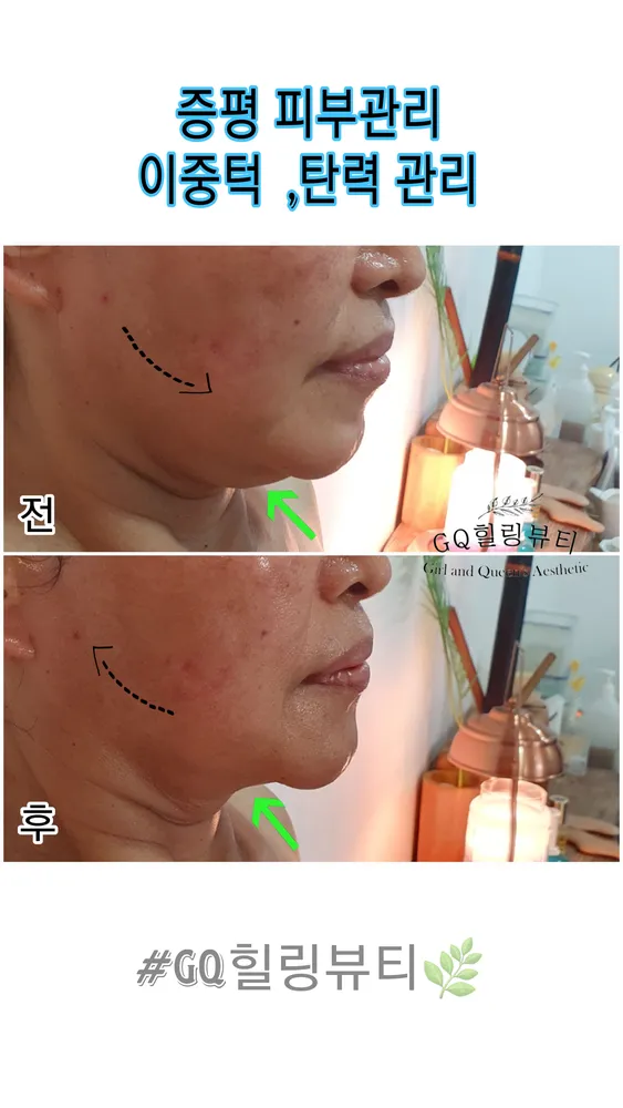GQ힐링뷰티 대표 이미지