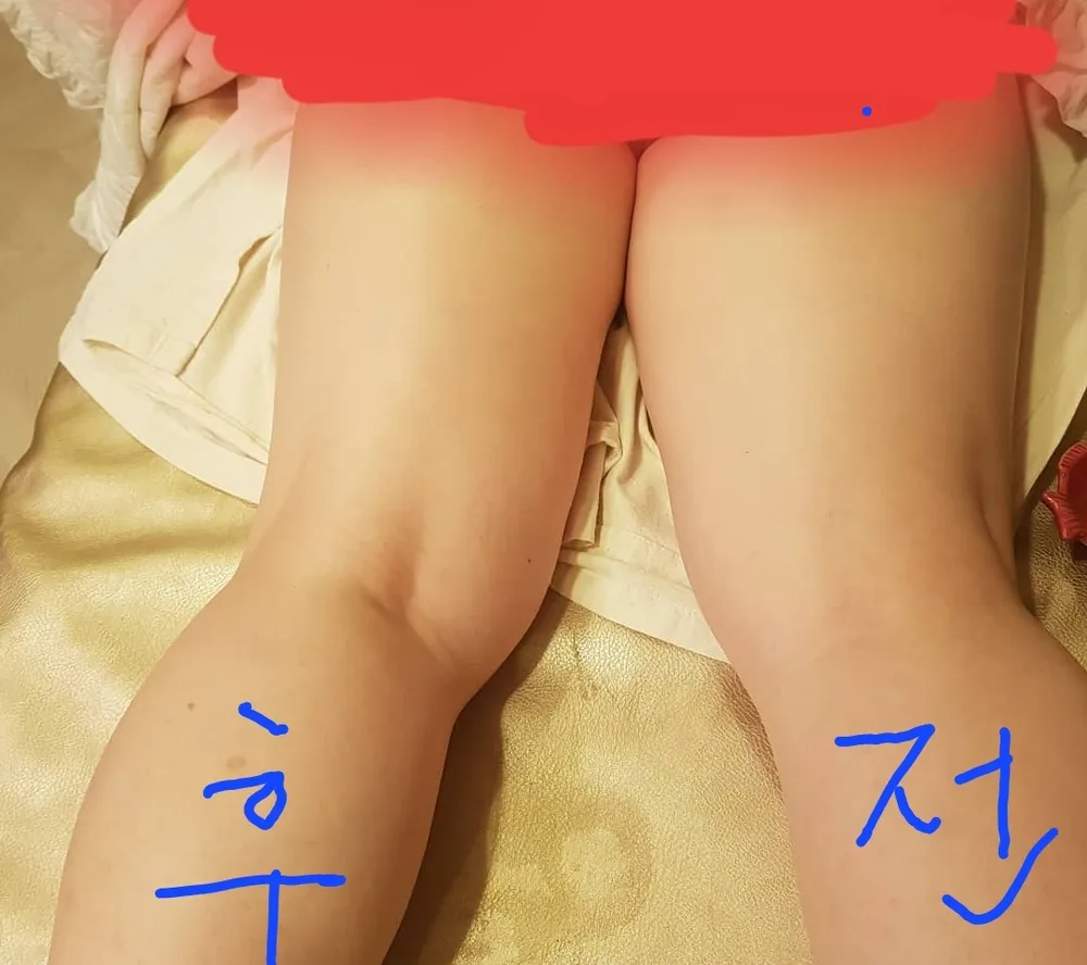 지비후스킨케어 대표 이미지