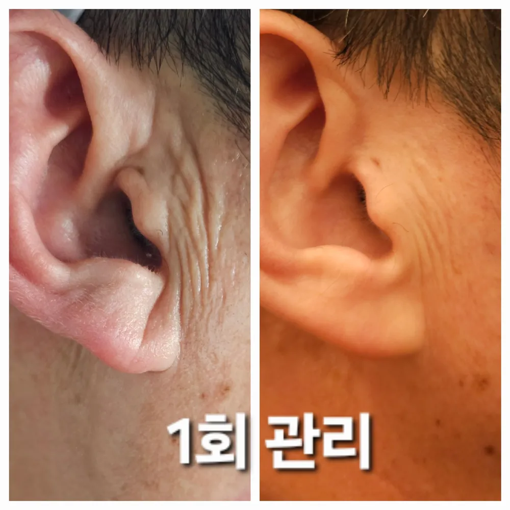 엘온느 대표 이미지
