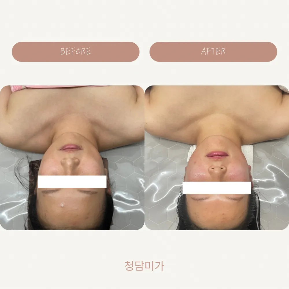 청담미가 대표 이미지