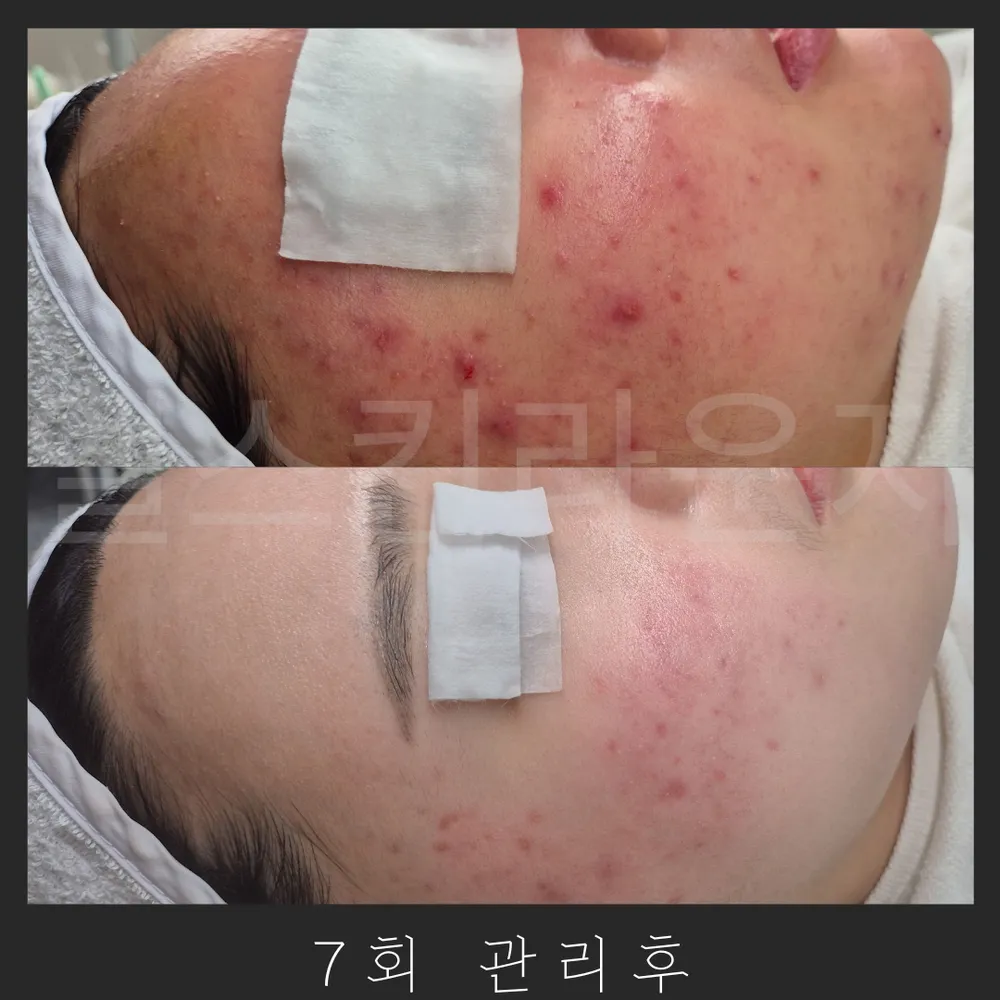 엘스킨라운지 강남역점 대표 이미지