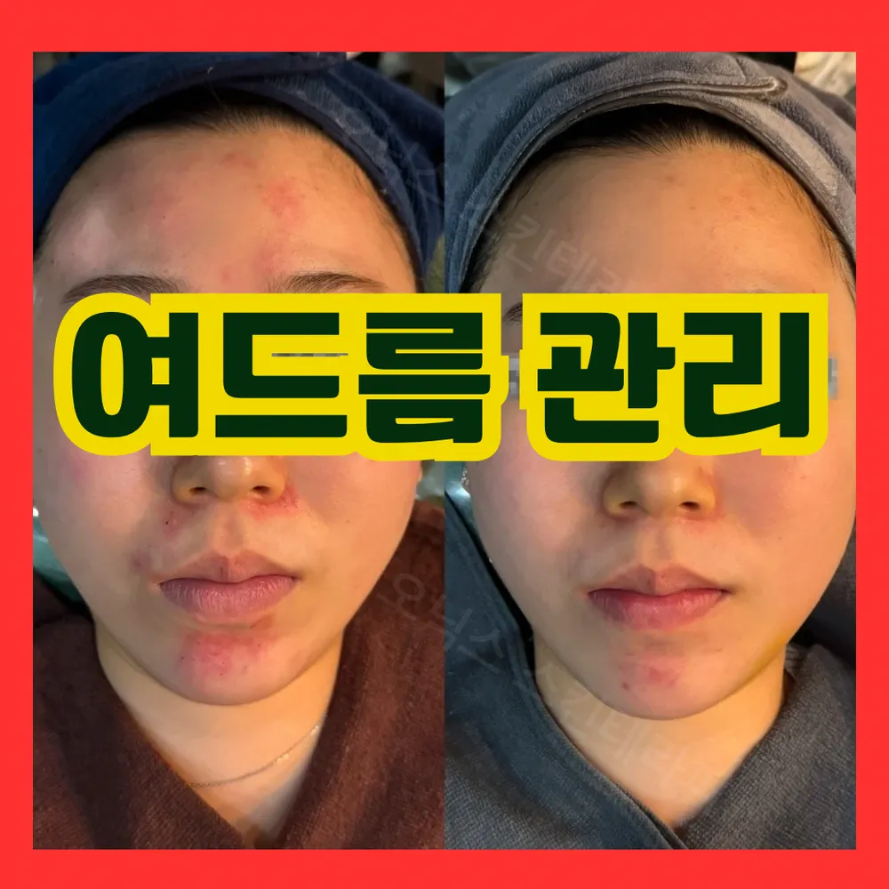 오닉스 스킨테라피 왕십리본점 대표 이미지