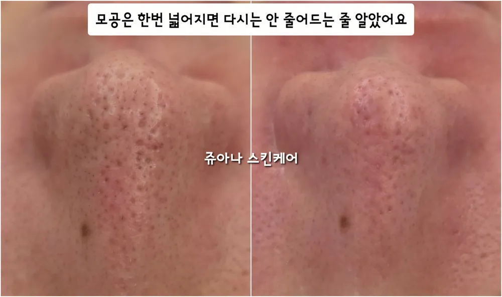 쥬아나스킨케어 대표 이미지