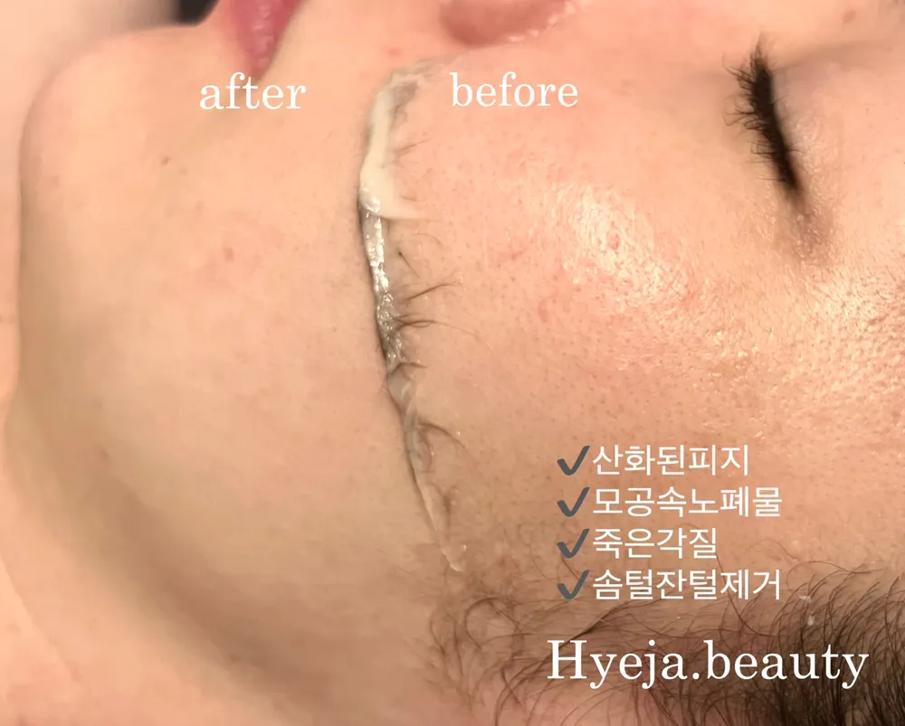 혜자뷰티 대표 이미지