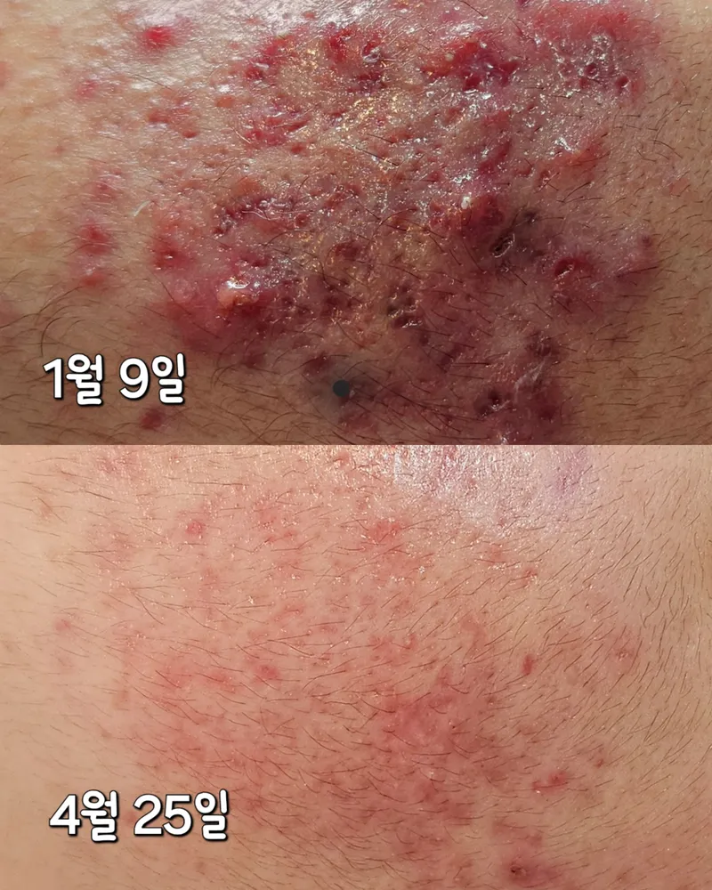 더,스킨 대표 이미지
