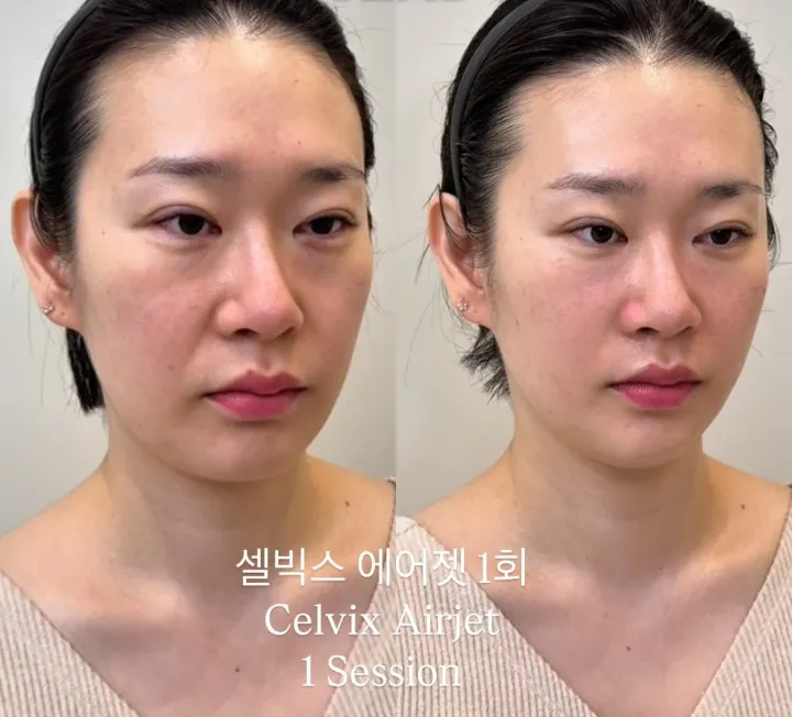 레이나피부미용센터 대표 이미지