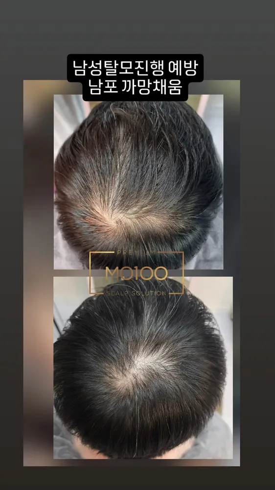 까망채움스칼프 대표 이미지