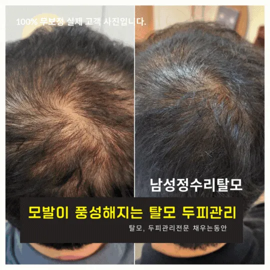 채우는동안 대표 이미지