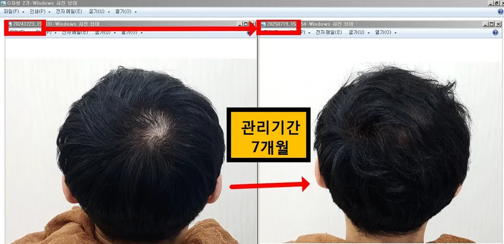 탈모 아미치 0.3 공덕점 대표 이미지