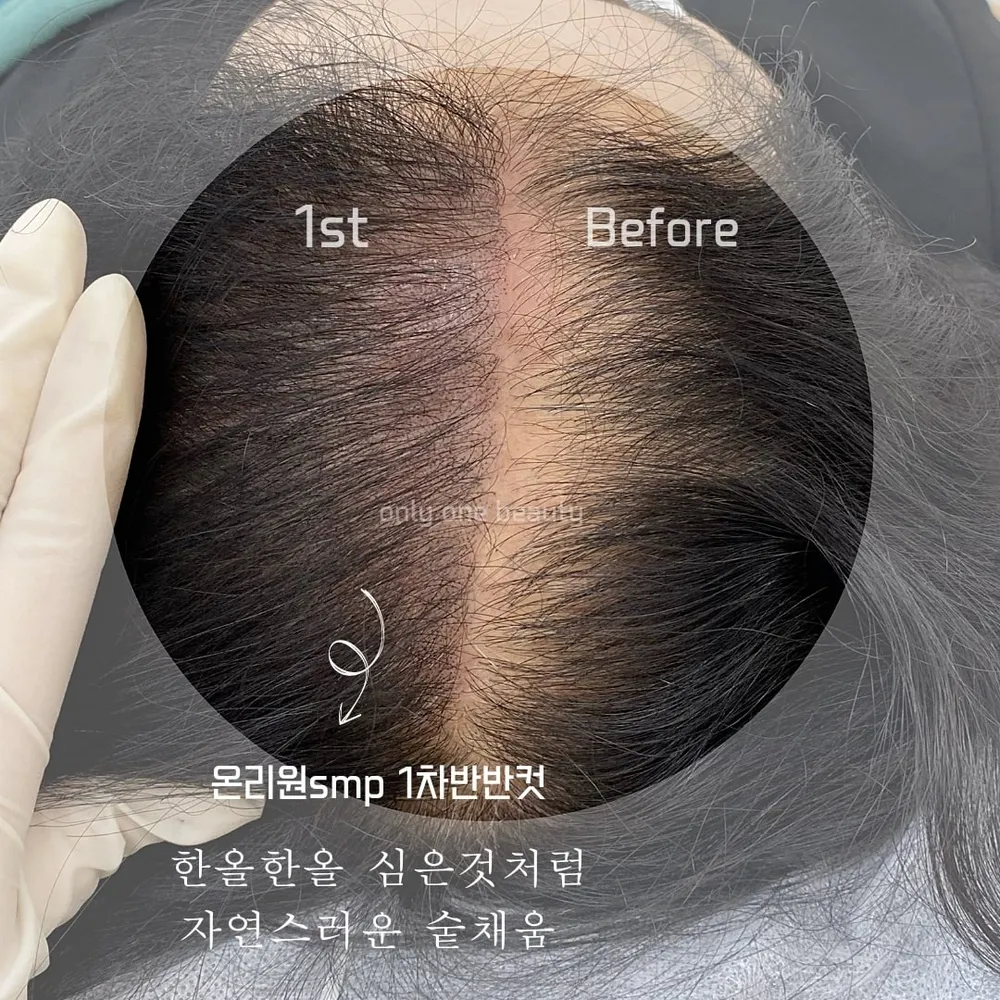 온리원뷰티 대표 이미지