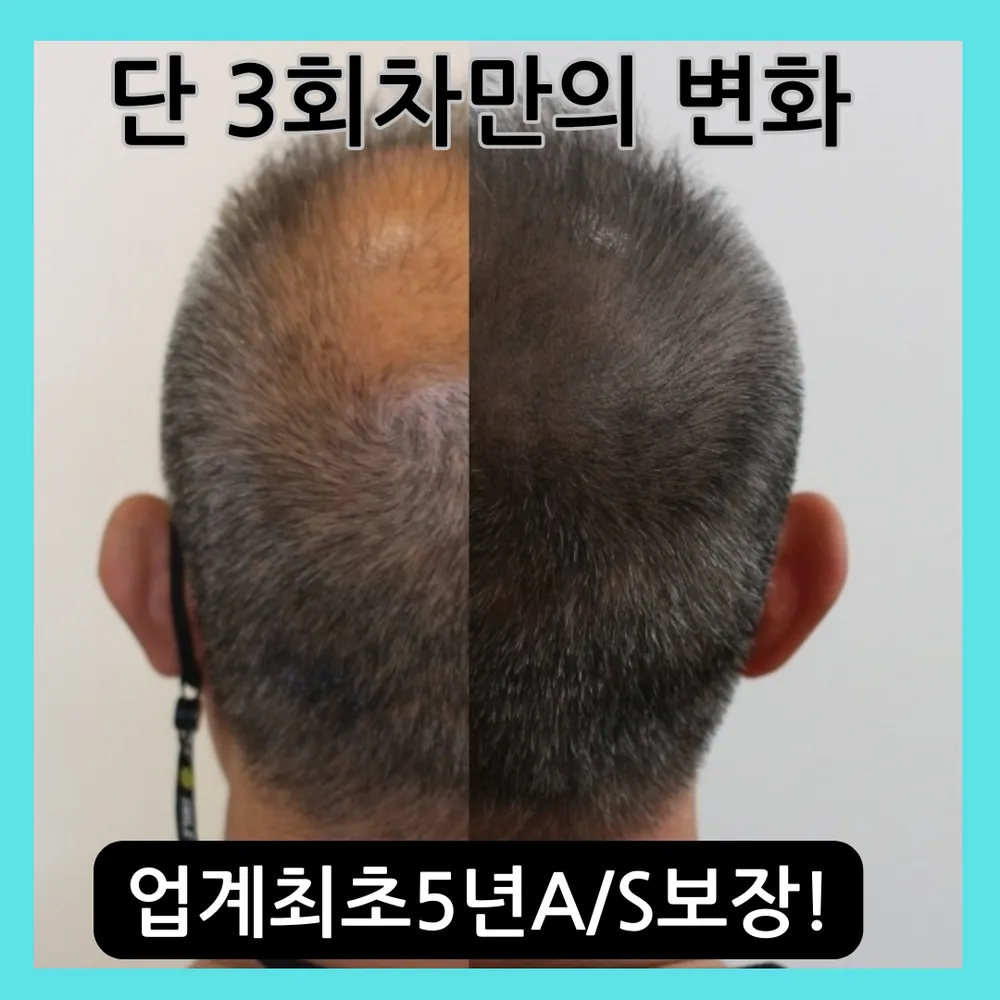 이송연두피연구소 대표 이미지