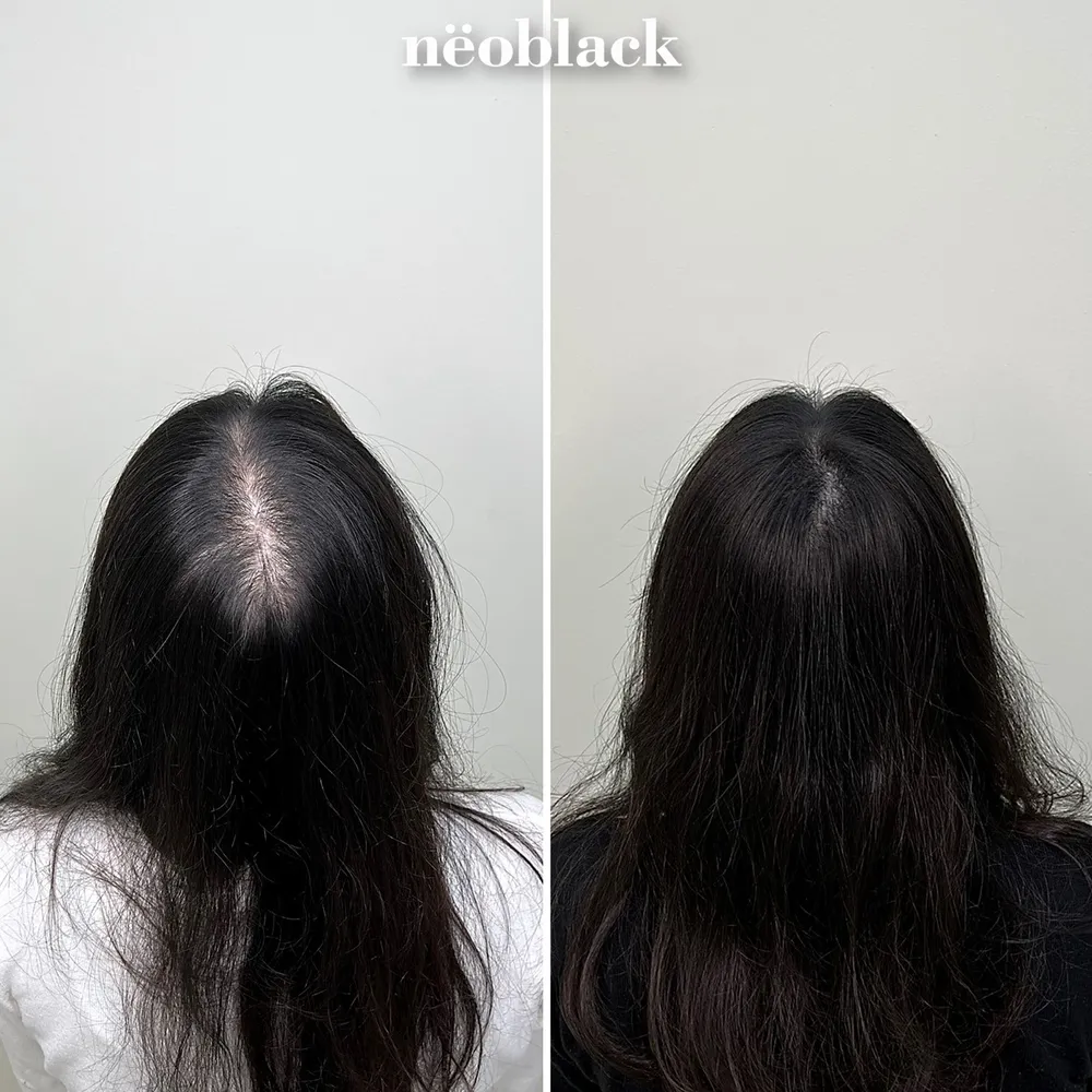 네오블랙 대표 이미지