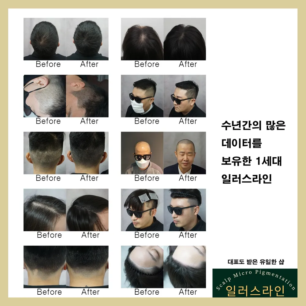 일러스라인 대표 이미지