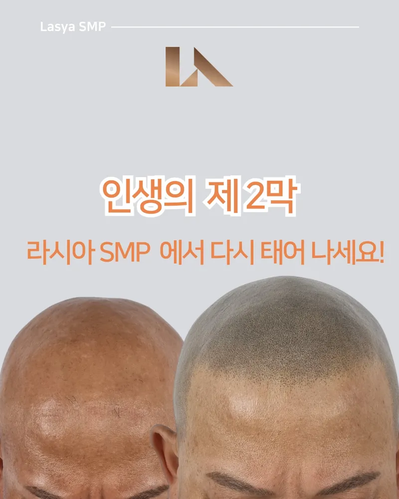 라시아뷰티 smp 대표 이미지