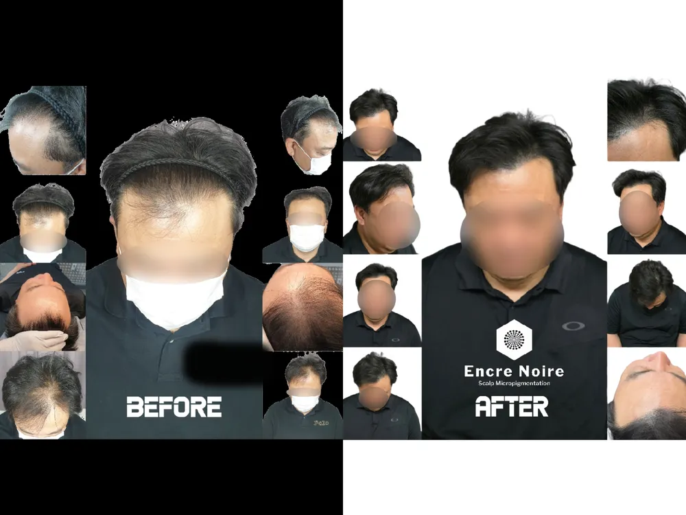 앙크르느와 대표 이미지