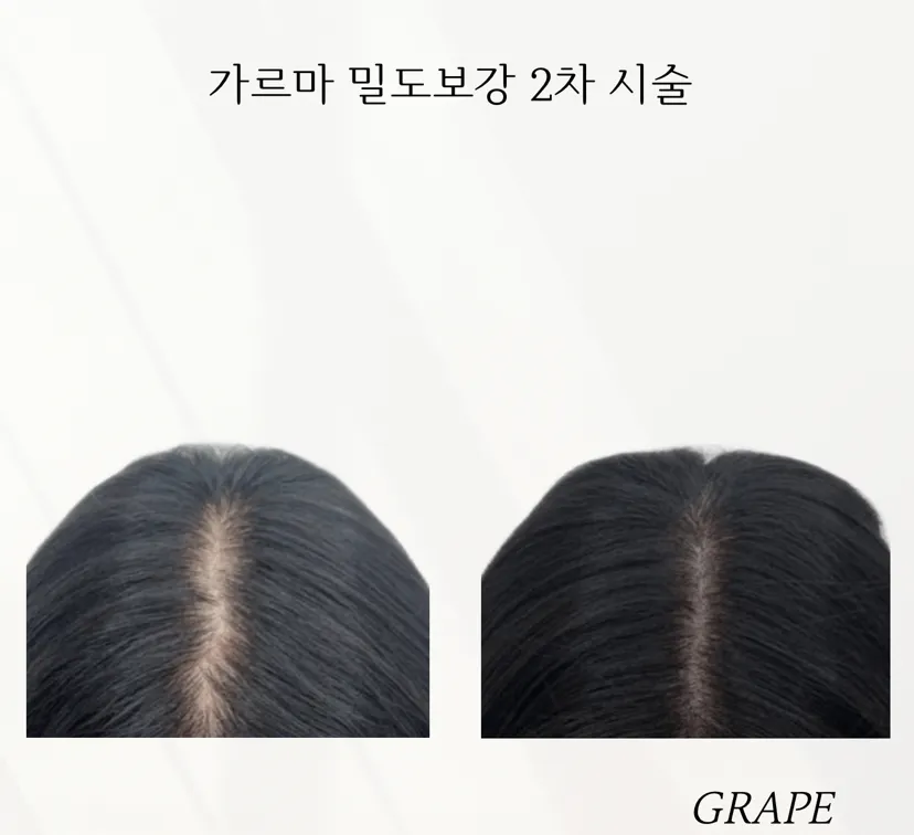 그레이프 smp 대표 이미지