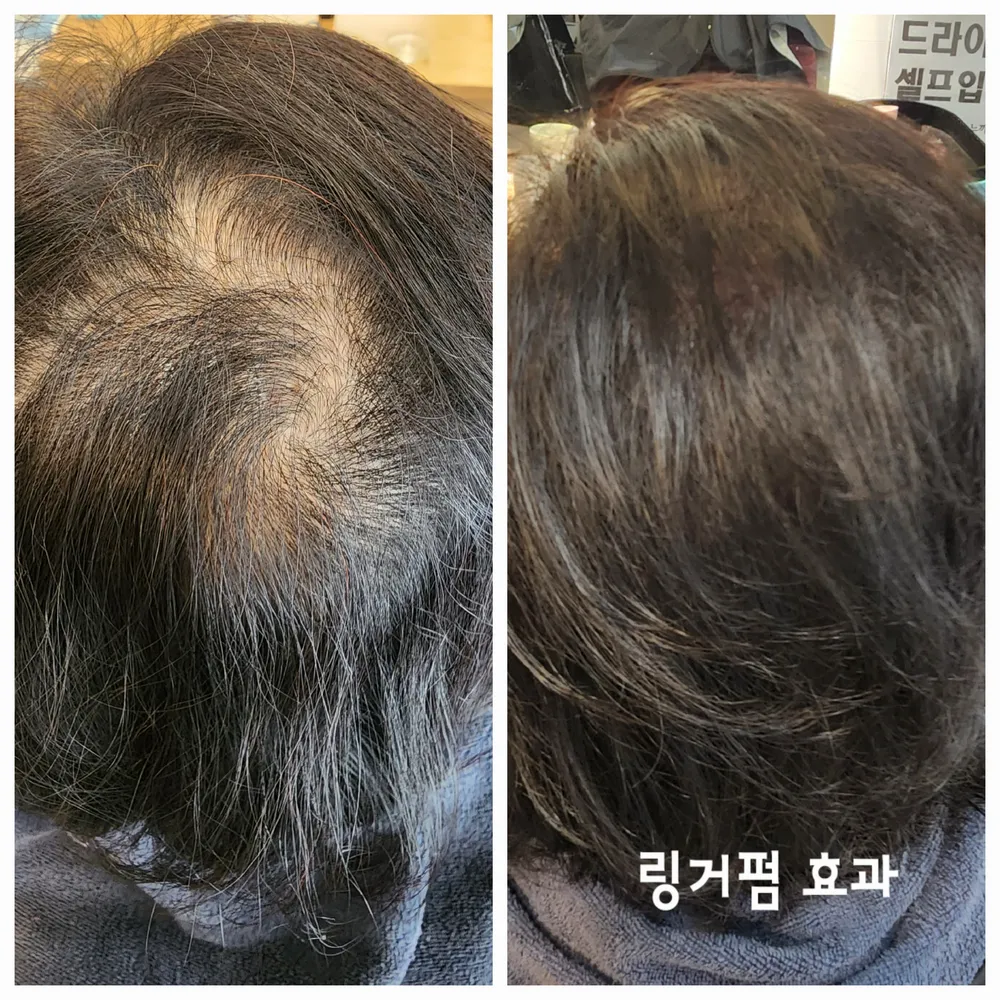 헤어헤모랩 대표 이미지