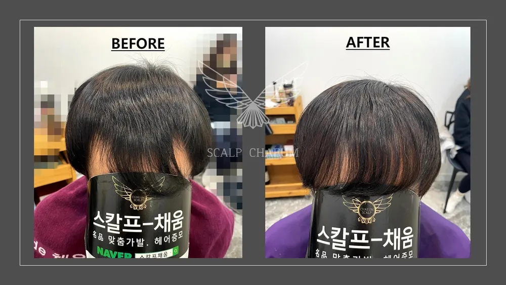 스칼프채움 대표 이미지