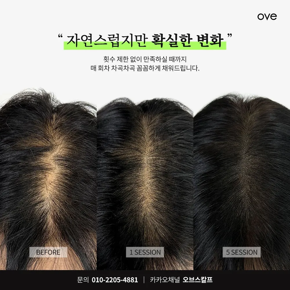 오브스칼프 대표 이미지