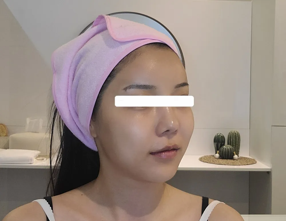 테크노 미친리프팅 피부샵 대표 이미지