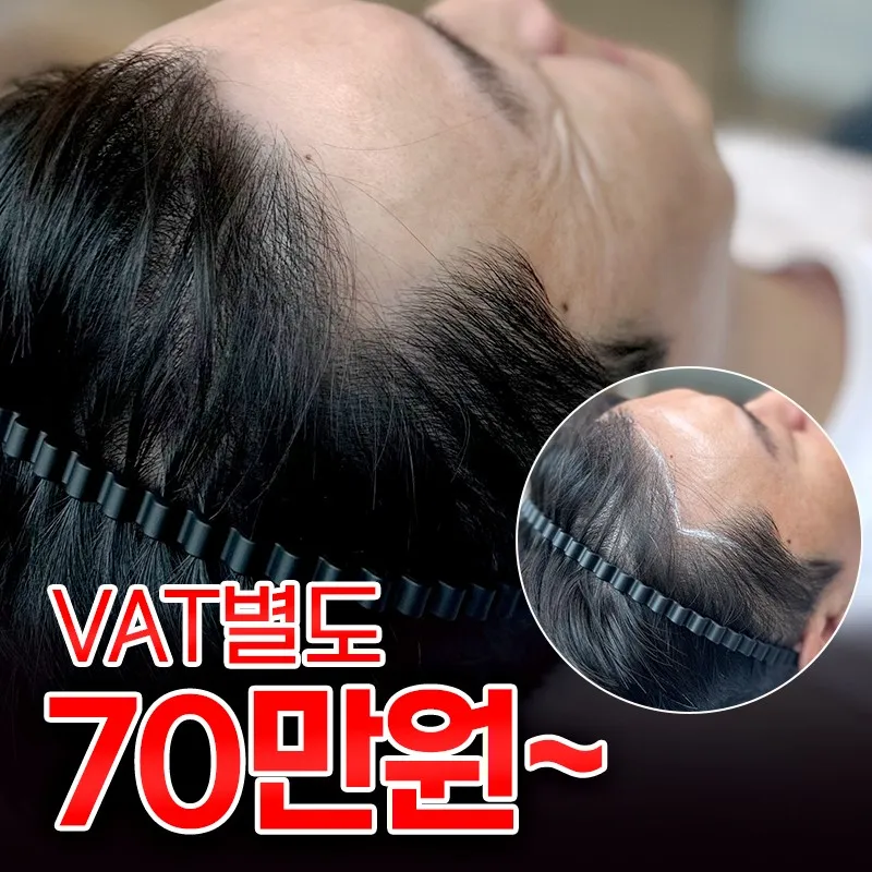 대구JK병원 두피문신센터 대표 이미지