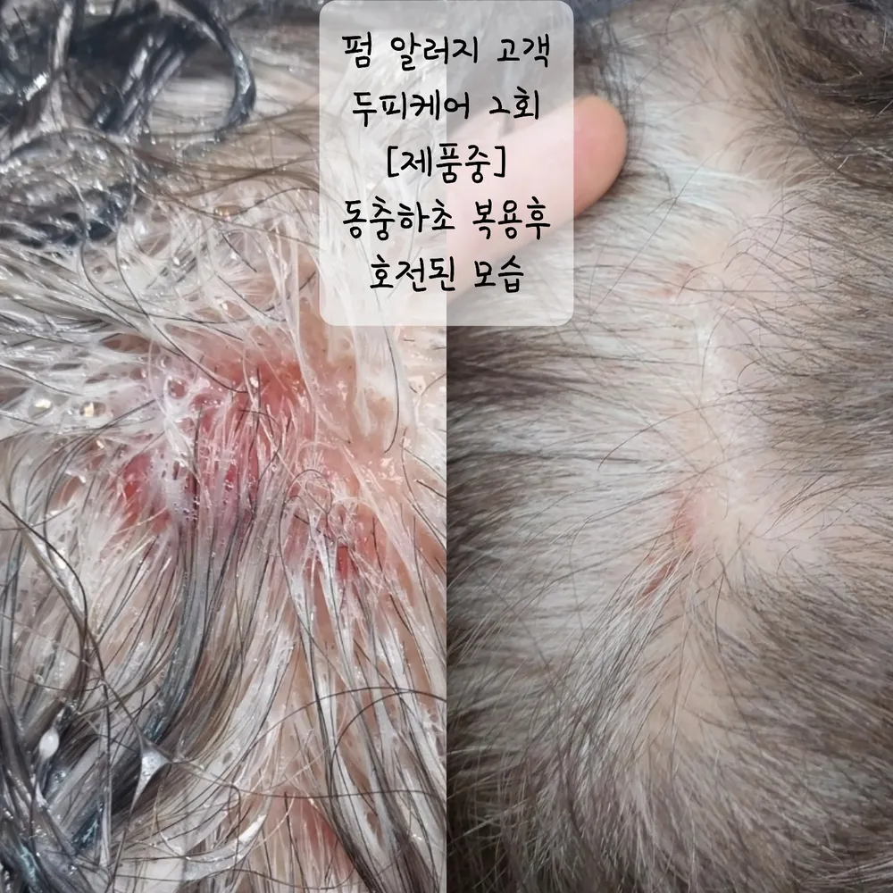 수앤큐사랑 염색 피부관리 속눈썹 두피탈모 대표 이미지