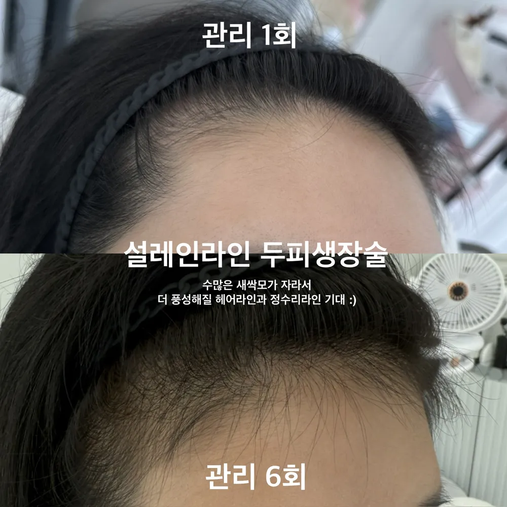 설레인라인 대표 이미지