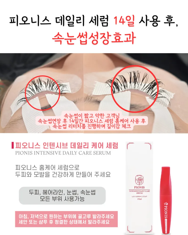 퀸즈스칼프 대표 이미지