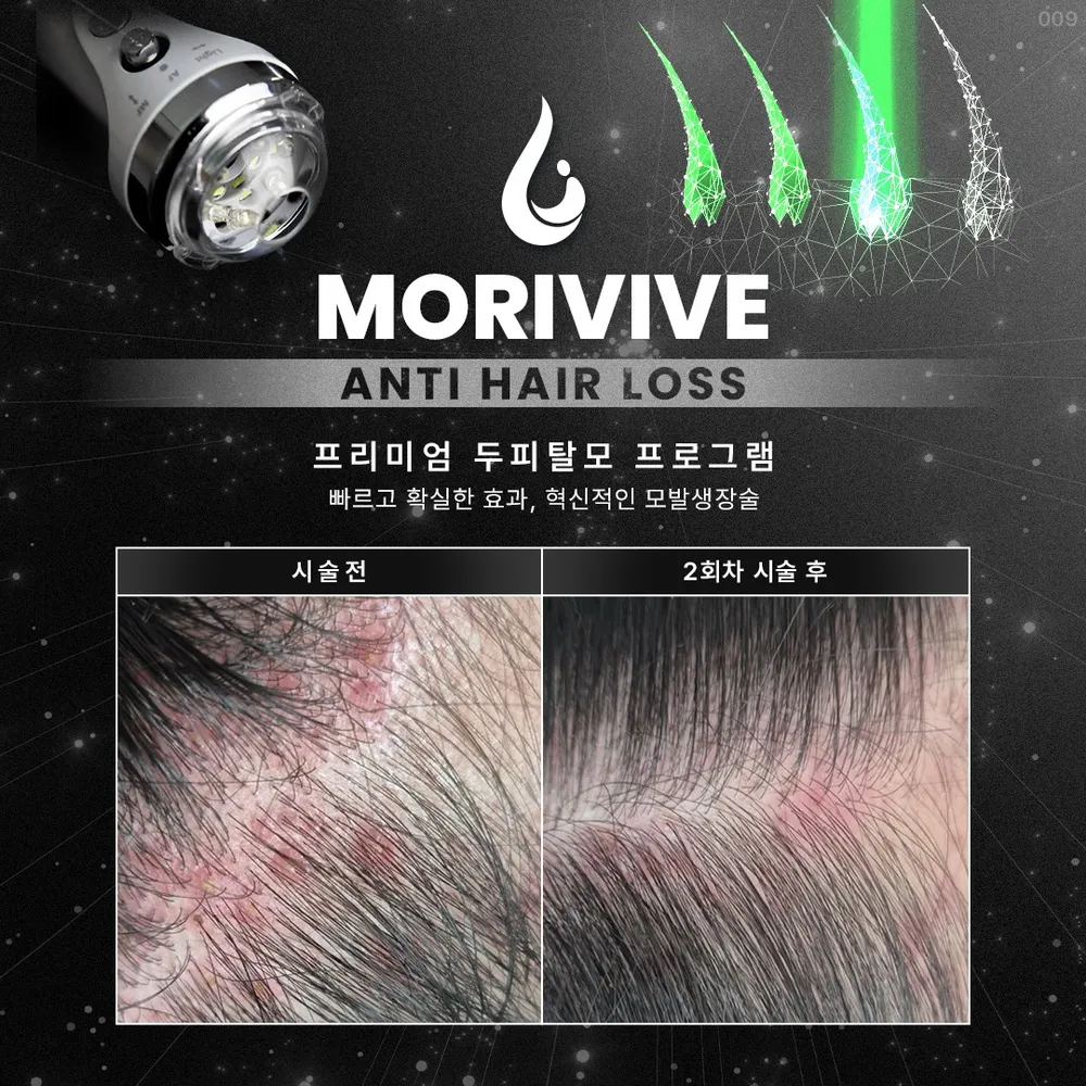 렛미인x모리바이브탈모&두피케어 인천부평점 대표 이미지