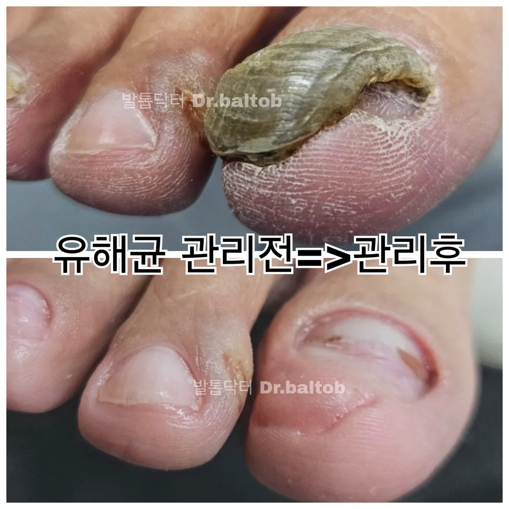 발톱닥터 대표 이미지